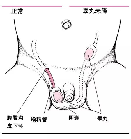 五个月宝宝蛋蛋正常图，了解婴儿睾丸发育的基础知识