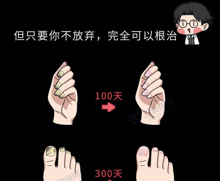 广东省灰指甲的概述与治疗